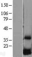 DUSP23 Protein (Over-Expression Lysate Myc-DDK (Flag))