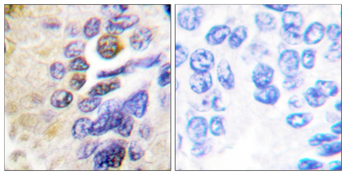IKBKG / NEMO / IKK Gamma Antibody (p31)