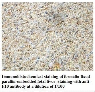 F10 / Factor X Antibody (aa314-485)