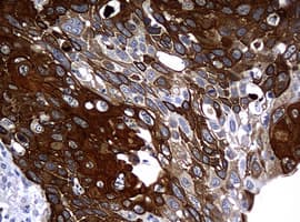 KRT14 / CK14 / Cytokeratin 14 Antibody (aa148-472, clone OTI3C7)