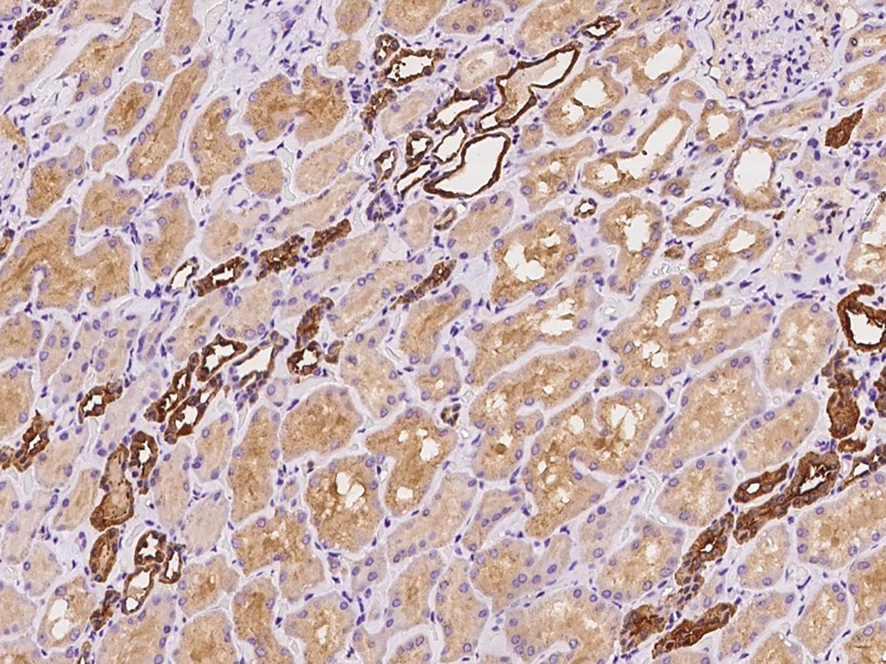 HPRT1 / HPRT Antibody