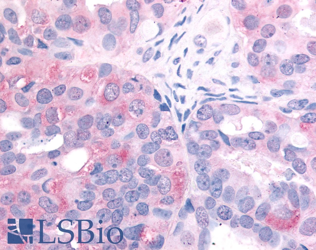 IHC-plus™ EGFR Antibody (C-Terminus)