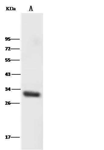 HOXB8 Antibody (Preservative Free)