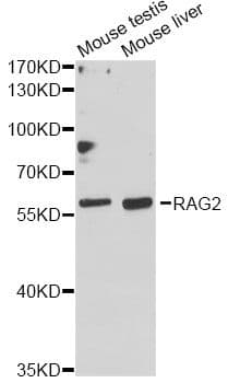 Polyclonal Rabbit anti-Human RAG2 / RAG-2 Antibody (WB)