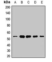 Polyclonal Rabbit anti-Human UQCRC1 Antibody (WB)