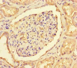 NOT1 / CNOT1 Antibody