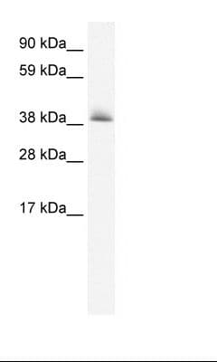 Polyclonal Rabbit anti-Human KCTD13 Antibody (aa26-75, IHC, WB)