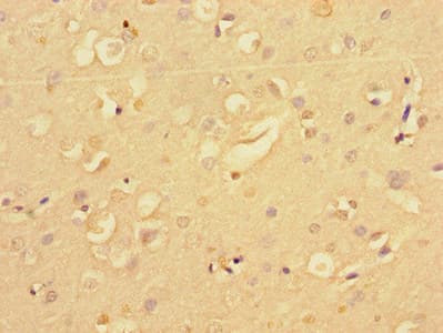 NF2 / Merlin Antibody