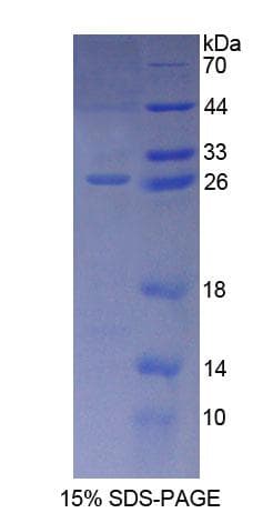 Human CD300C Protein (Recombinant His-T7)