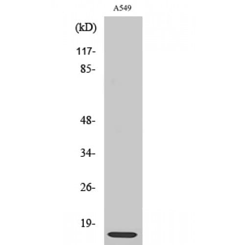RPL30 / Ribosomal Protein L30 Antibody (40-120 aa, C-terminal)