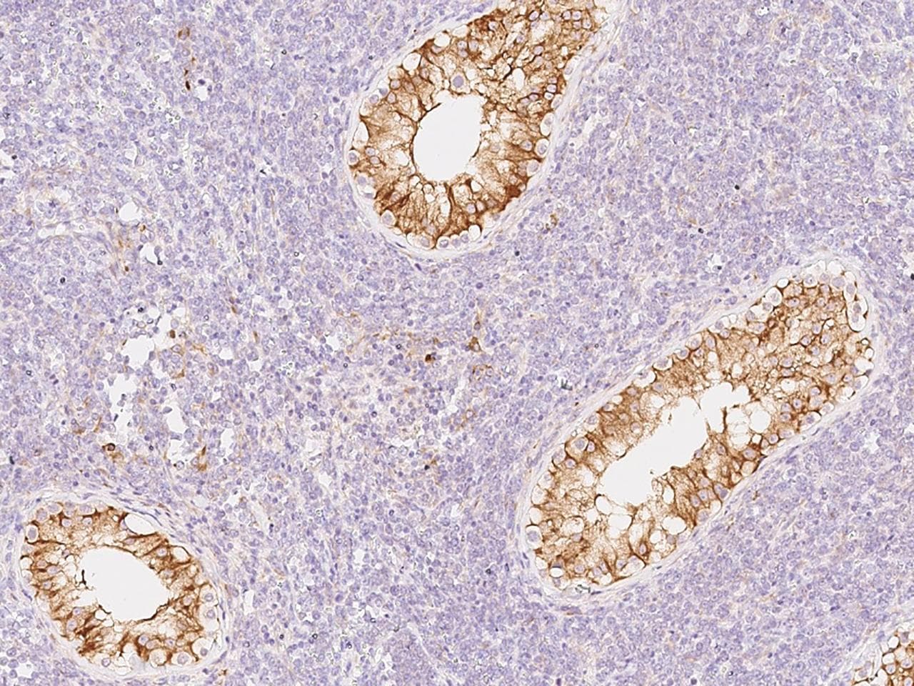 PRDX4 / Peroxiredoxin 4 Antibody (Preservative Free)