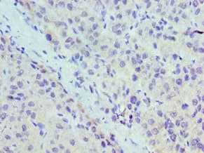 UBC6 / UBE2J2 Antibody (aa1-230)