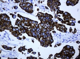 Monoclonal Mouse anti-Human ABCB1 / MDR1 / P Glycoprotein Antibody (clone OTI5B3, IHC)