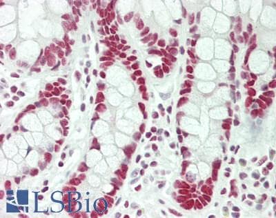IHC-plus™ Polyclonal Rabbit anti-Human HNRPA1 / HnRNP A1 Antibody (Internal, IHC, IF, WB)
