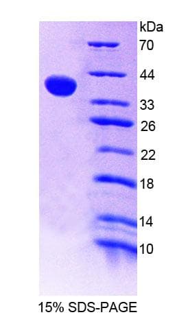 Mouse RICK / RIP2 Protein (Recombinant His-T7)