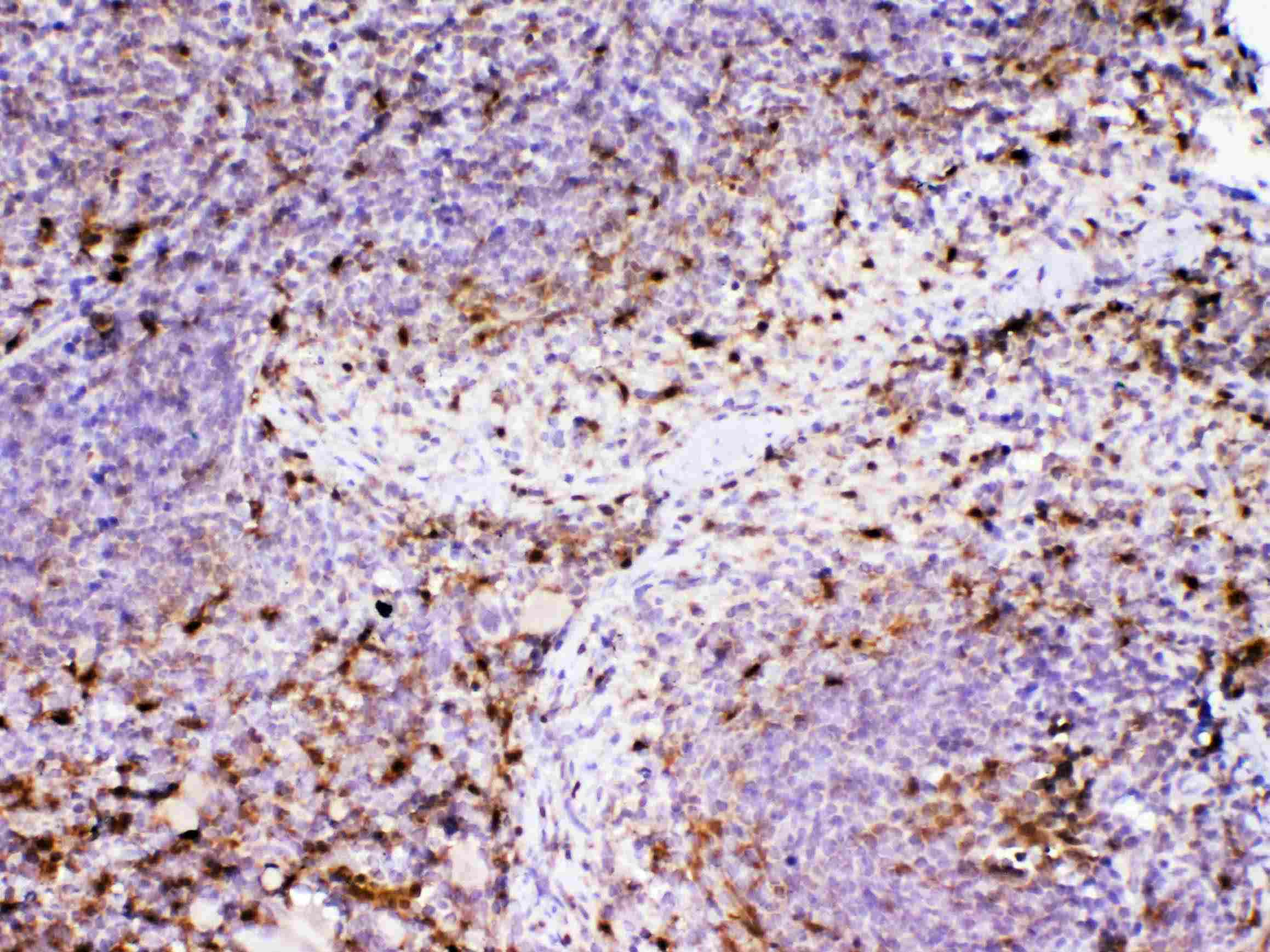 ADA / Adenosine Deaminase Antibody