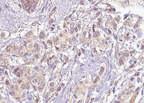 CDC25C Antibody (phospho-Ser216)