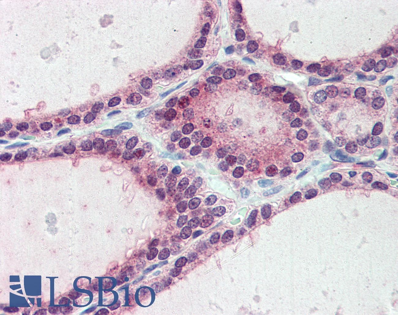 IHC-plus™ ESYT1 Antibody (Internal)