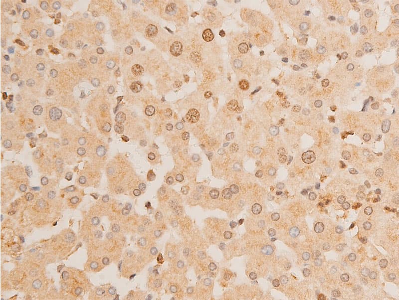 TP73 / p73 Antibody (phospho-Tyr99)