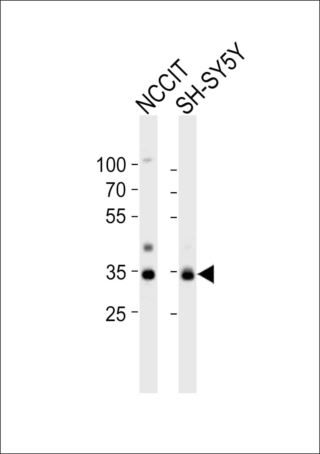 Polyclonal Rabbit anti-Human WDR82 / TMEM113 Antibody (aa12-46, WB)