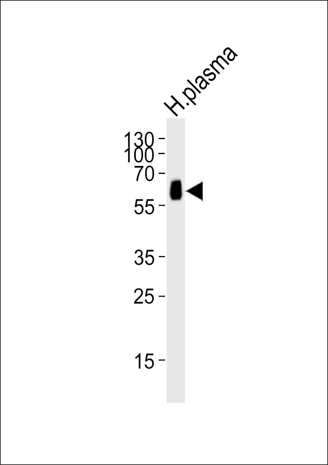 Polyclonal Rabbit anti-Human CNDP1 Antibody (aa128-142, WB)