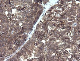 Monoclonal Mouse anti-Human PIK3R5 Antibody (clone OTI4G9, IHC, IF, WB)