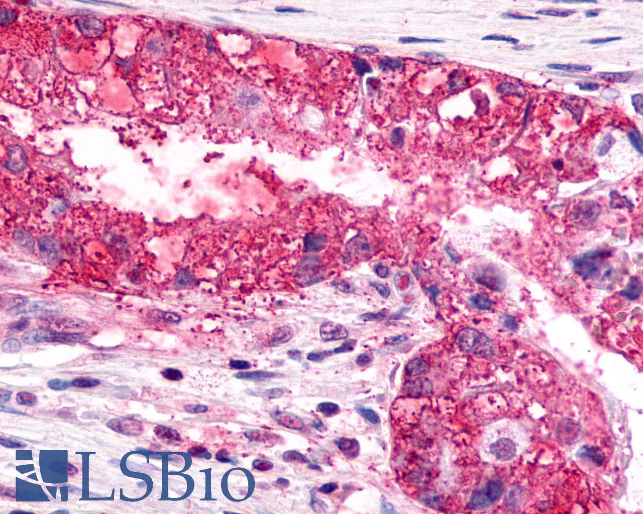 IHC-plus™ Polyclonal Rabbit anti-Human CXCR6 Antibody (Cytoplasmic Domain, IHC)