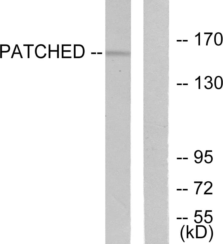 IHC-plus™ PTCH1 / Patched 1 Antibody (aa1-50)
