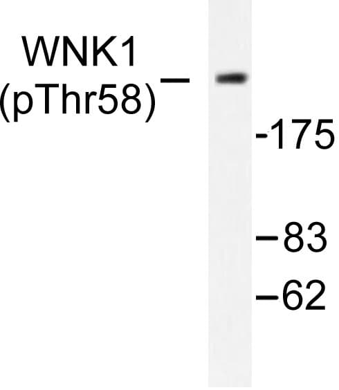 WNK1 Antibody (phospho-Thr60)