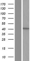 Human NSDHL Protein (Over-Expression Lysate Myc-DDK (Flag))
