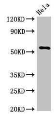 KRT7 / CK7 / Cytokeratin 7 Antibody