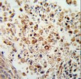 FPR3 / FPRL2 Antibody (aa307-333)