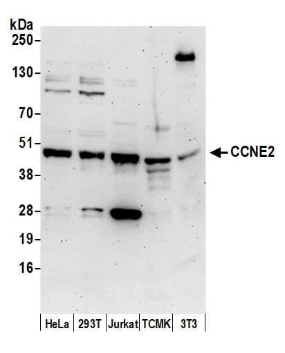 CCNE2 / Cyclin E2 Antibody (aa354-404)