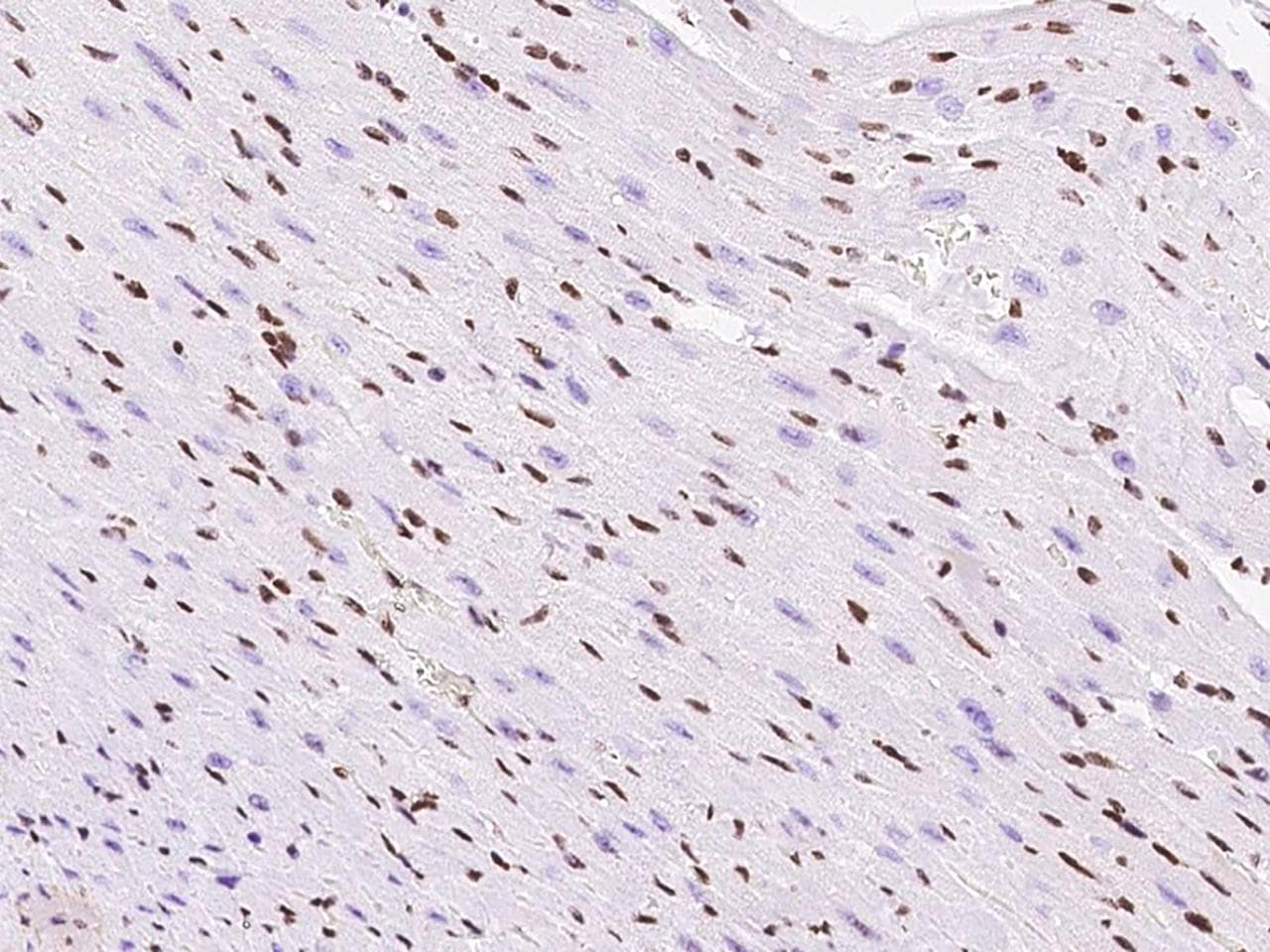 TBX5 Antibody (Preservative Free)