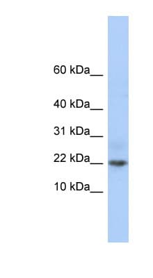 C9orf25 Antibody (C-Terminus)