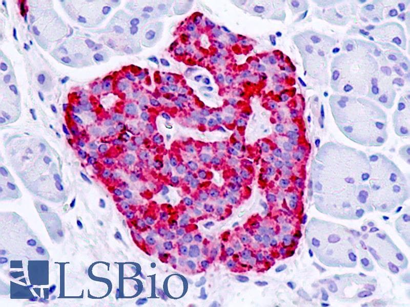 PathPlus™ Polyclonal Rabbit anti-Human GPER1 / GPR30 Antibody (Cytoplasmic Domain, IHC, IF, WB)