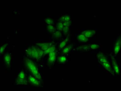 Polyclonal Rabbit anti-Human HIST1H2AI Antibody (IF)