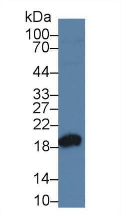 SOD1 / Cu-Zn SOD Antibody (aa2-154)
