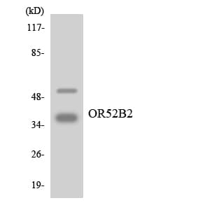 Polyclonal Rabbit anti-Human OR52B2 Antibody (aa191-240, WB)