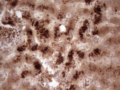 PHGDH Antibody (clone OTI9C2)