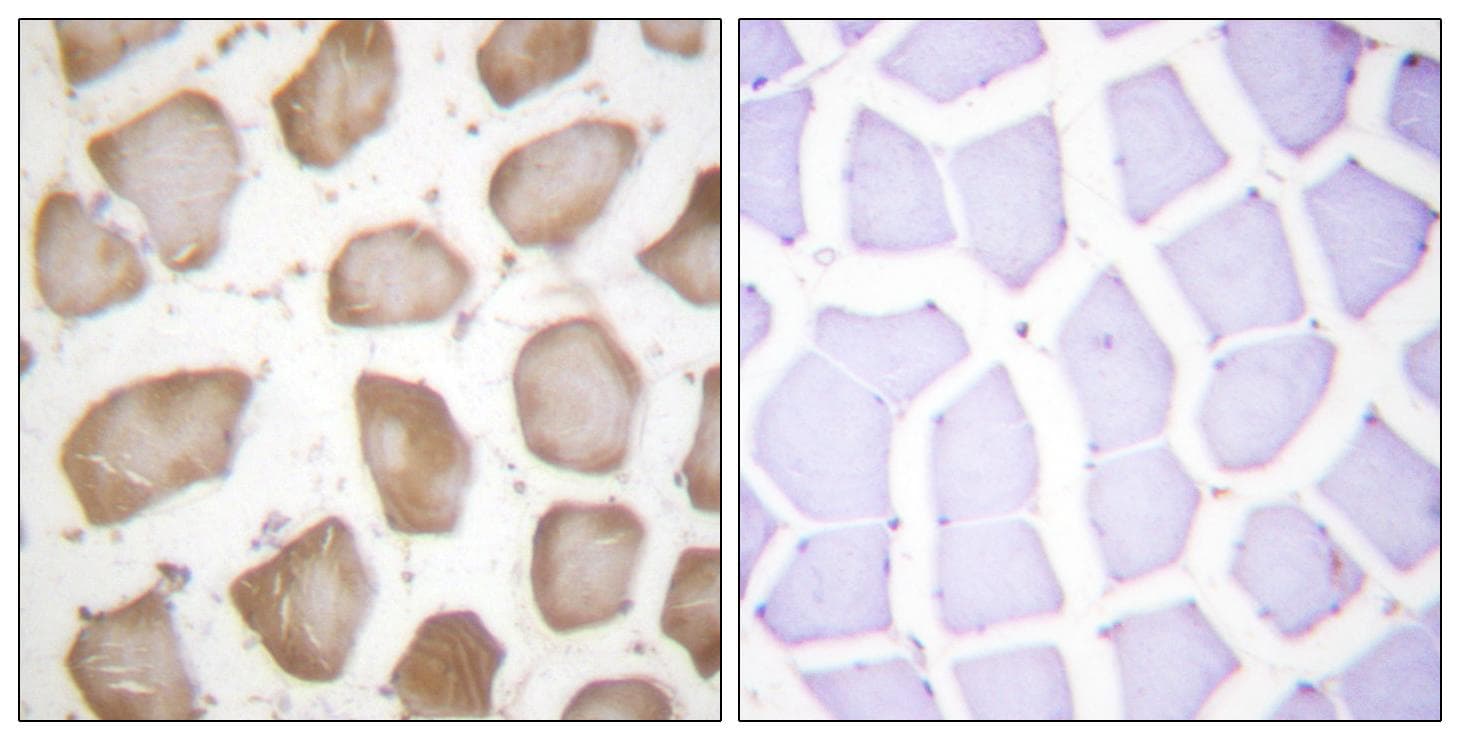 Polyclonal Rabbit anti-Human ALOX5 / 5-LOX Antibody (p271, IHC, WB)