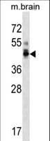 Polyclonal Rabbit anti-Human PPP1R7 Antibody (aa312-340, WB)