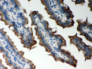 PRDX5 / Peroxiredoxin 5 Antibody