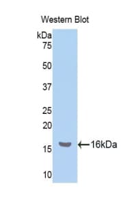 NPM1 / NPM / Nucleophosmin Antibody (aa20-154, APC)