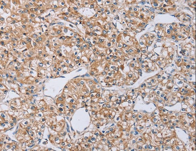 EDA / Ectodysplasin A Antibody