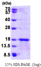 Human GLRX5 / Glutaredoxin 5 Protein (Recombinant His)