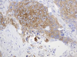 CD99 Antibody (clone OTI5C8)