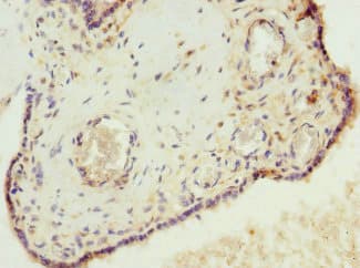 Polyclonal Rabbit anti-Human VHLL Antibody
