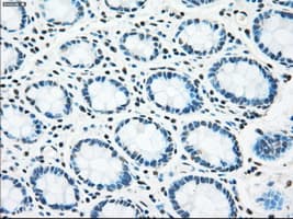 Monoclonal Mouse anti-Human STK3 Antibody (clone OTI2D4, IHC, WB)