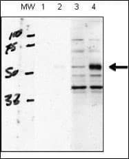 ACVRL1 Antibody (aa38-68)